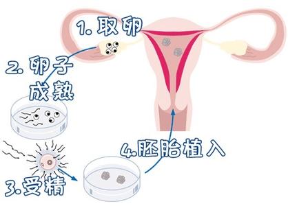 周顾问